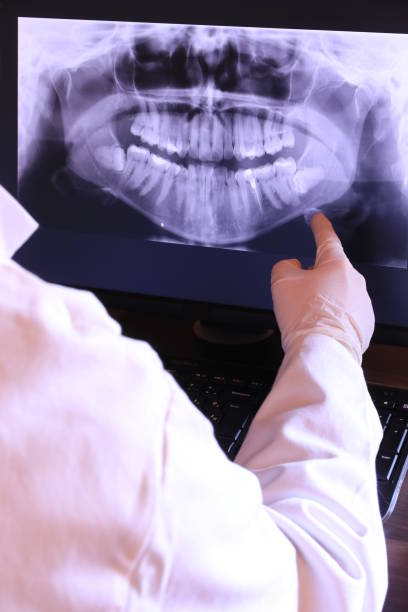 Best Emergency Treatment for Dental Infections or Abscesses in Tullytown, PA