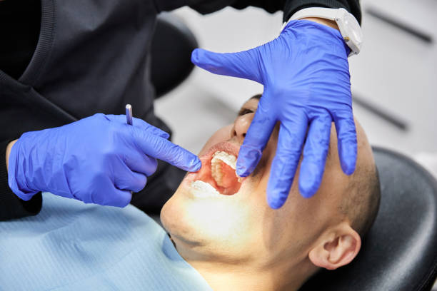 Best Emergency Gum Treatment in Tullytown, PA