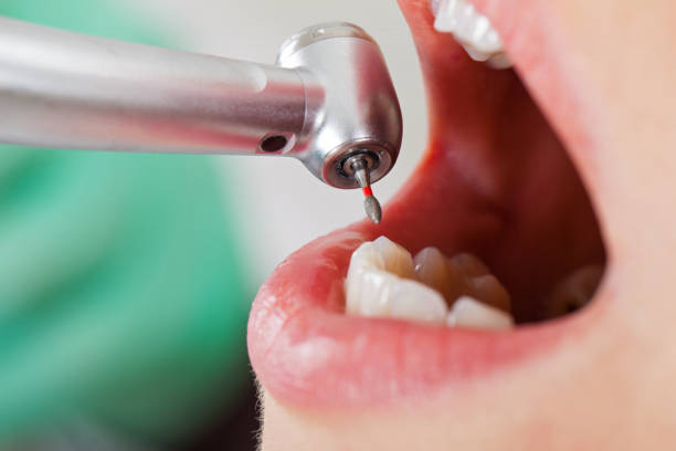 Best Urgent Care for Lost Fillings or Crowns in Tullytown, PA